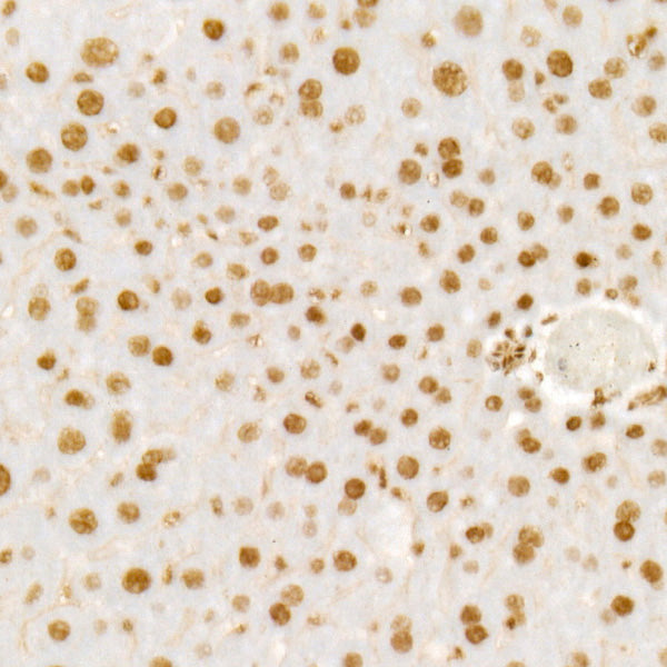 WTAP Rabbit mAb
