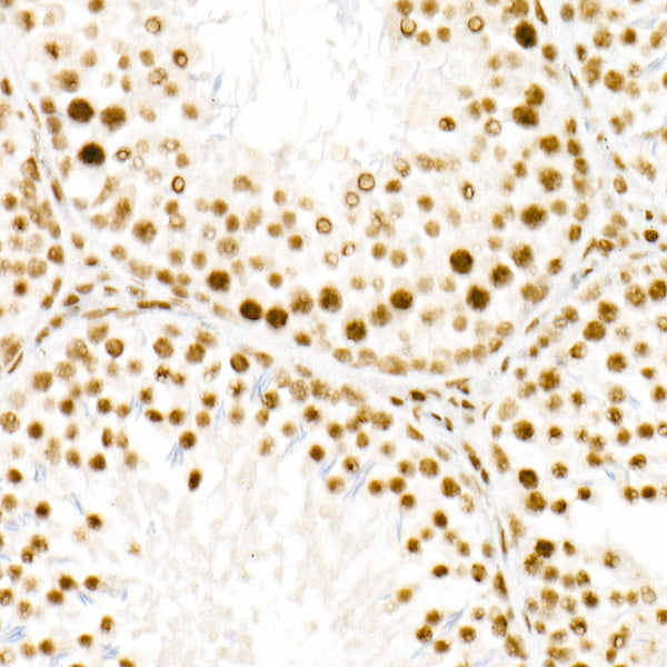 WTAP Rabbit mAb