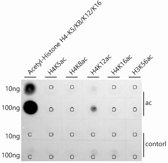 Acetyl-Histone H4-K12 Rabbit mAb