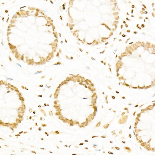 Acetyl-Histone H4-K12 Rabbit mAb