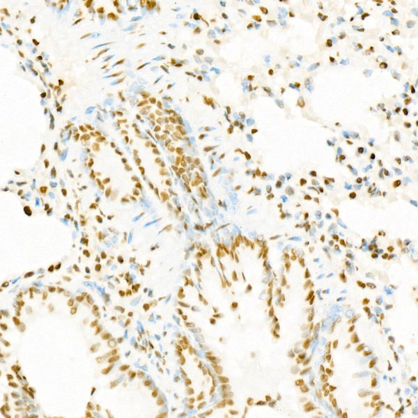 Acetyl-Histone H4-K12 Rabbit mAb