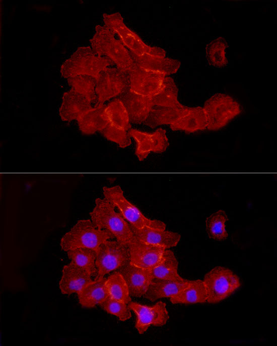 JAM-A/CD321/F11R Rabbit mAb