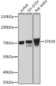 STK39 Rabbit mAb
