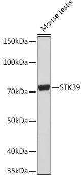 STK39 Rabbit mAb