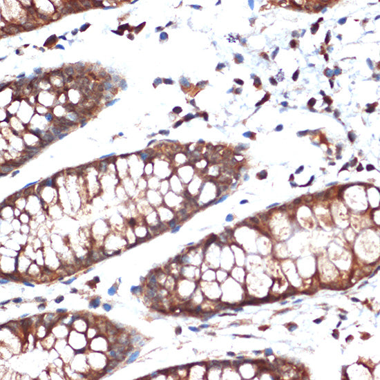 STK39 Rabbit mAb