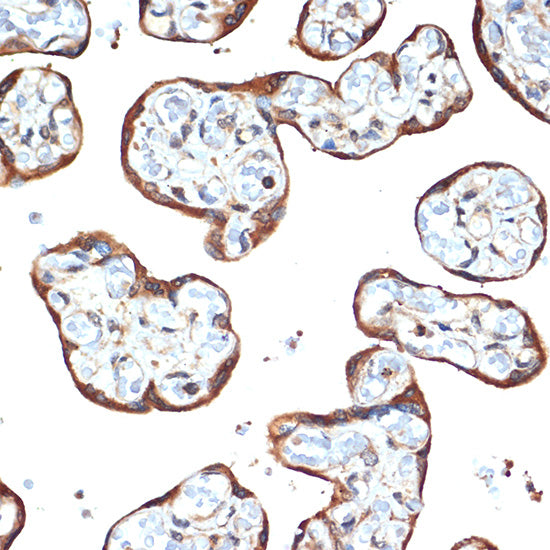 STK39 Rabbit mAb