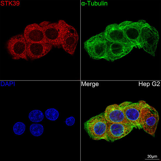 STK39 Rabbit mAb