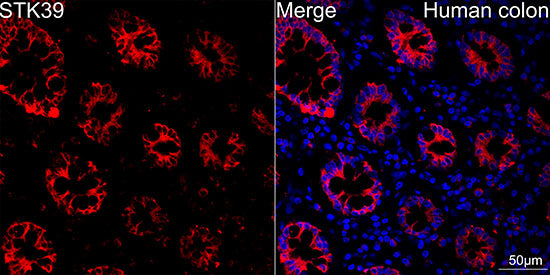 STK39 Rabbit mAb