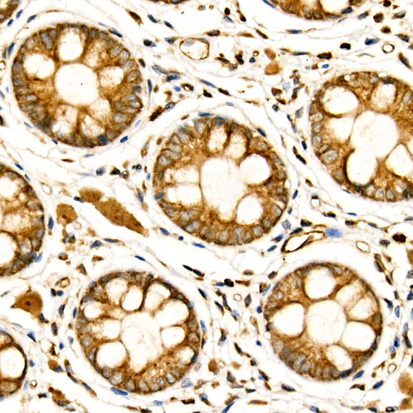 NGLY1 Rabbit mAb