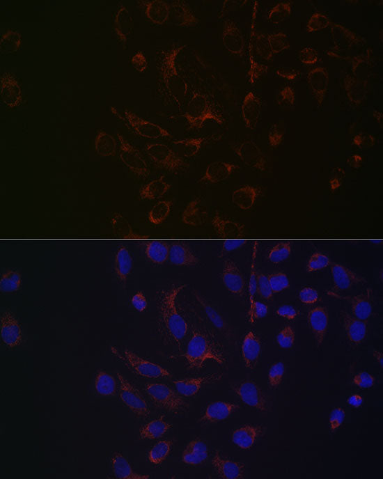 NGLY1 Rabbit mAb