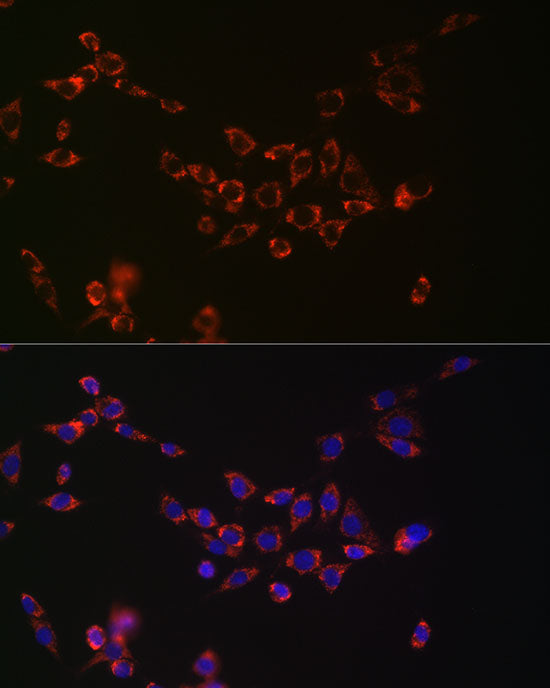NGLY1 Rabbit mAb