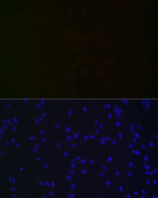 NGLY1 Rabbit mAb