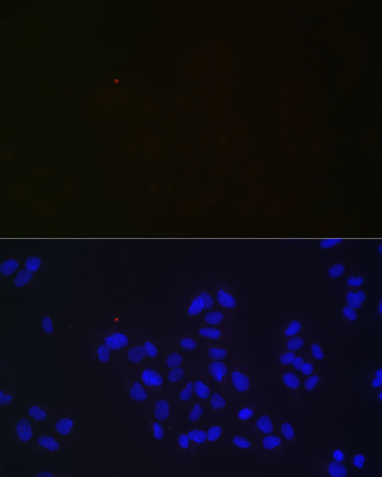 NGLY1 Rabbit mAb