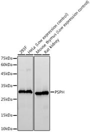 PSPH Rabbit mAb
