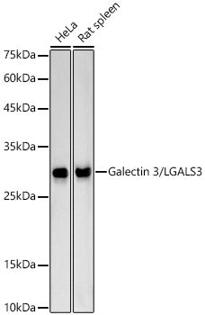 Galectin 3/LGALS3 Rabbit mAb