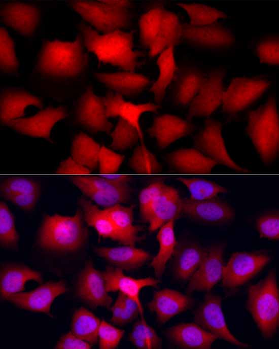 Galectin 3/LGALS3 Rabbit mAb