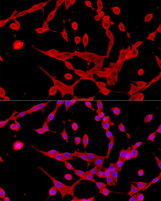 Galectin 3/LGALS3 Rabbit mAb