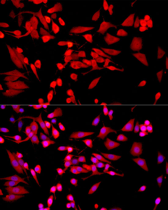 Galectin 3/LGALS3 Rabbit mAb