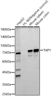 TAP1 Rabbit mAb