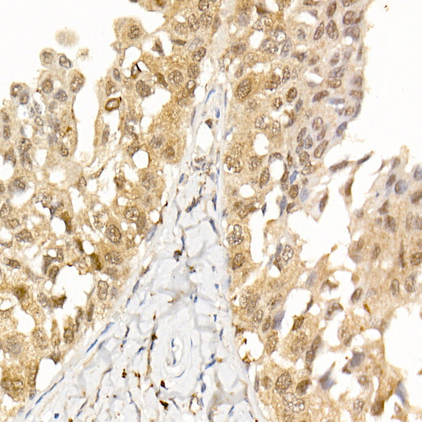 [KO Validated] AKT1 Rabbit mAb