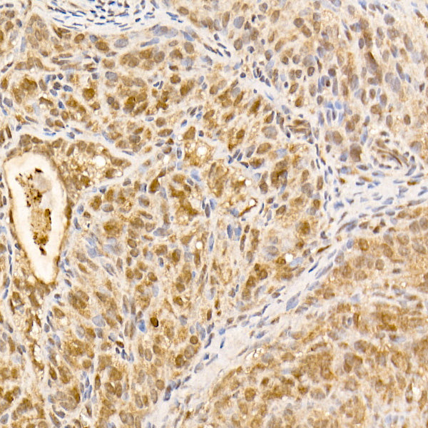 [KO Validated] AKT1 Rabbit mAb