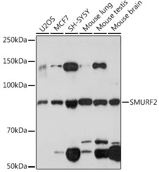 SMURF2 Rabbit mAb