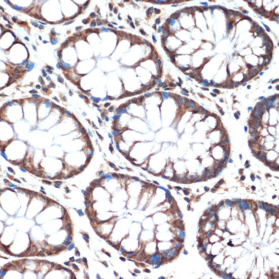 SMURF2 Rabbit mAb