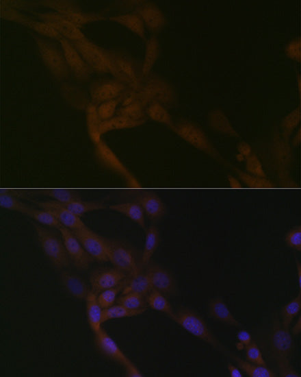 SMURF2 Rabbit mAb