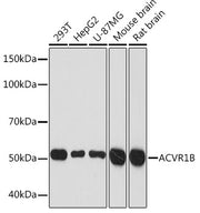 ACVR1B Rabbit mAb