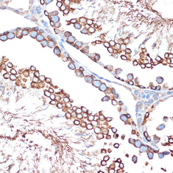 ACVR1B Rabbit mAb