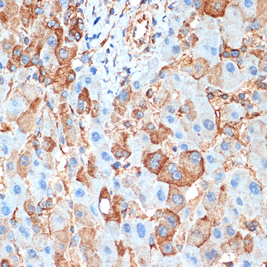ACVR1B Rabbit mAb