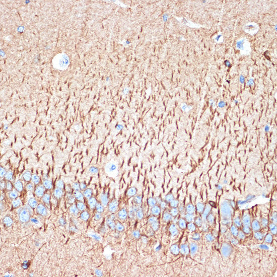 ACVR1B Rabbit mAb