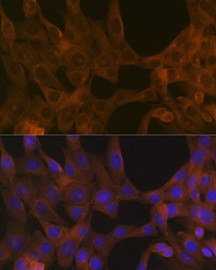 ACVR1B Rabbit mAb