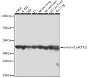 α-Actin-1 (ACTA1) Rabbit mAb