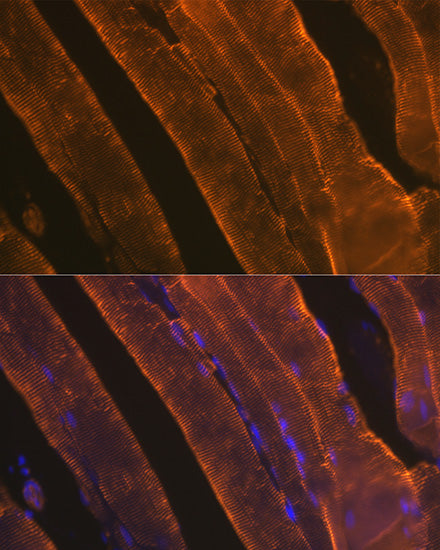 α-Actin-1 (ACTA1) Rabbit mAb