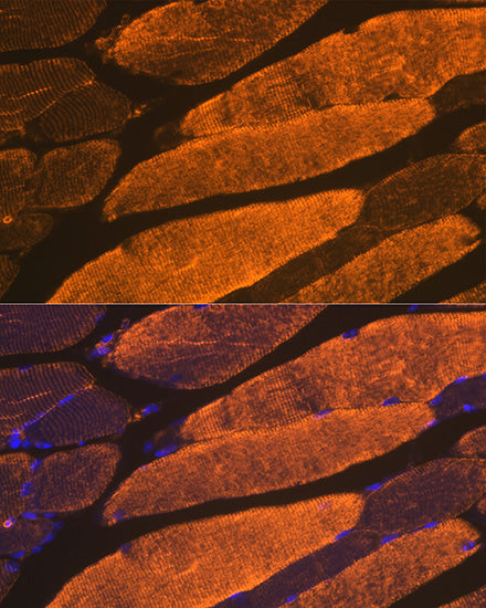 α-Actin-1 (ACTA1) Rabbit mAb