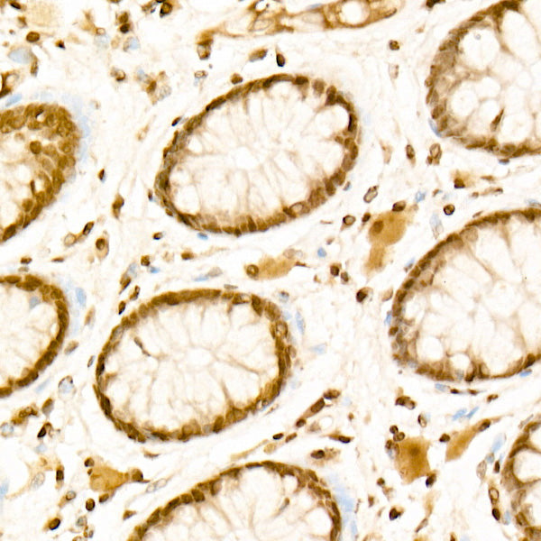 MonoMethyl-Histone H3-K36 Rabbit mAb