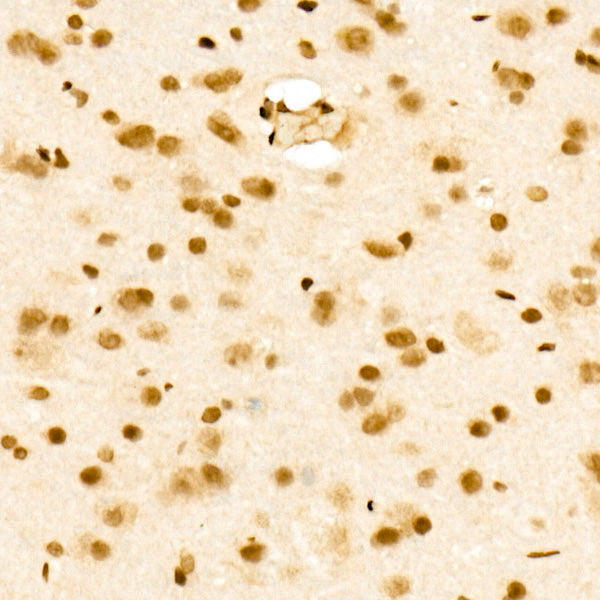 MonoMethyl-Histone H3-K36 Rabbit mAb