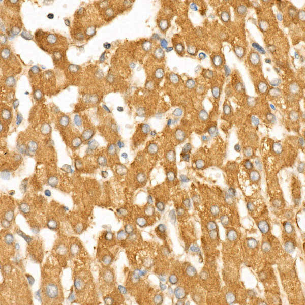 Caspase-12 Rabbit mAb