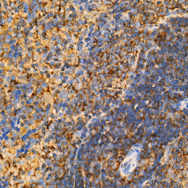 Caspase-12 Rabbit mAb