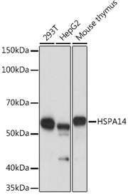 HSPA14 Rabbit mAb