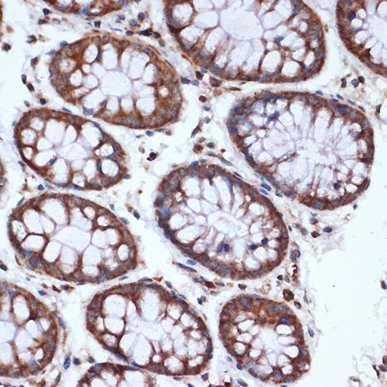 HSPA14 Rabbit mAb