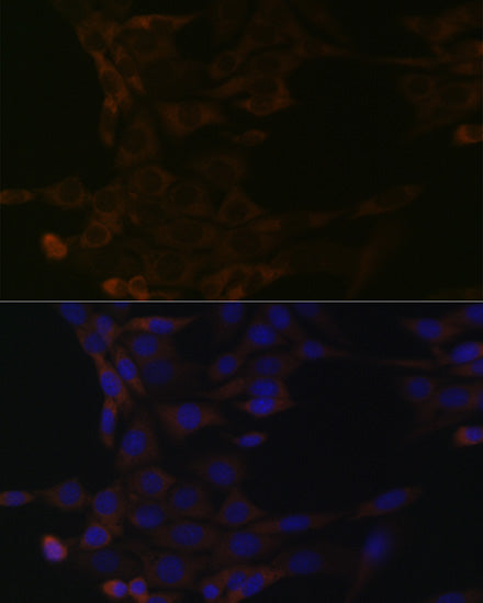 HSPA14 Rabbit mAb