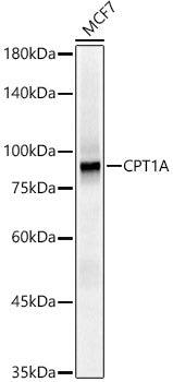[KO Validated] CPT1A Rabbit mAb