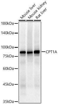 [KO Validated] CPT1A Rabbit mAb