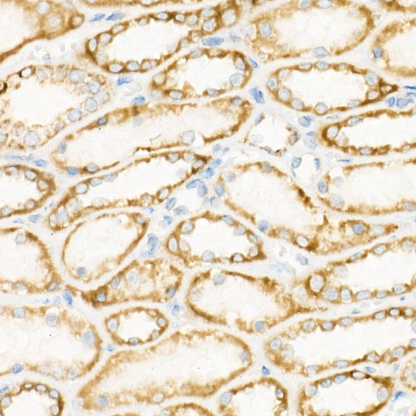 [KO Validated] CPT1A Rabbit mAb