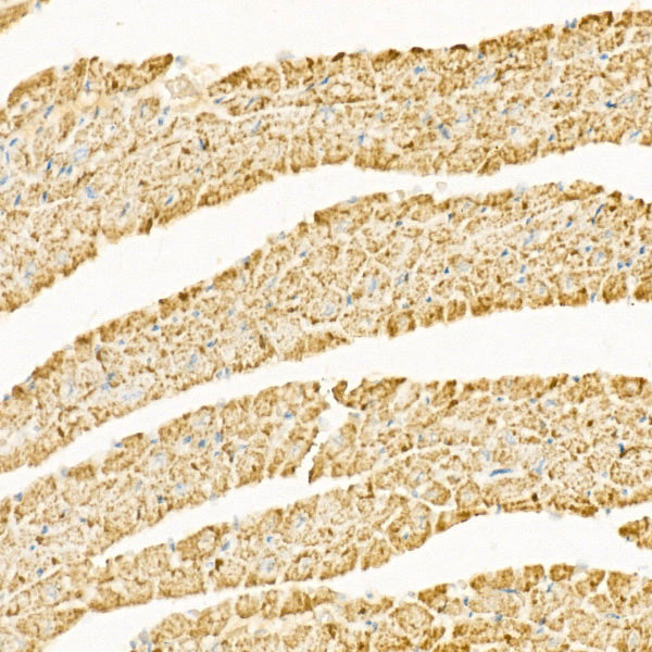 [KO Validated] CPT1A Rabbit mAb
