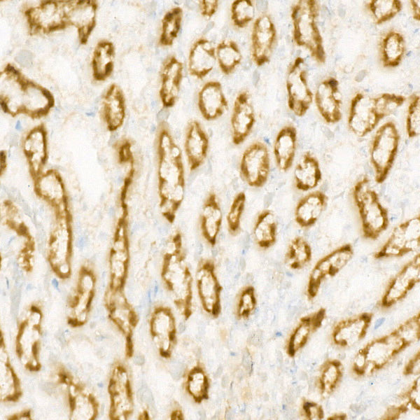 [KO Validated] CPT1A Rabbit mAb