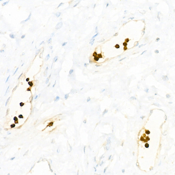 Myeloperoxidase (MPO) Rabbit mAb