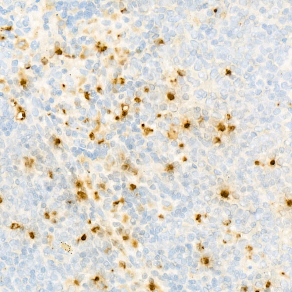 Myeloperoxidase (MPO) Rabbit mAb